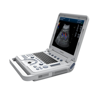 VET Veterinary Portable Ultrasound Scanner Laptop Machine Color Doppler For Pregnancy In Animals - FLORANZANI- Beauté & Santé