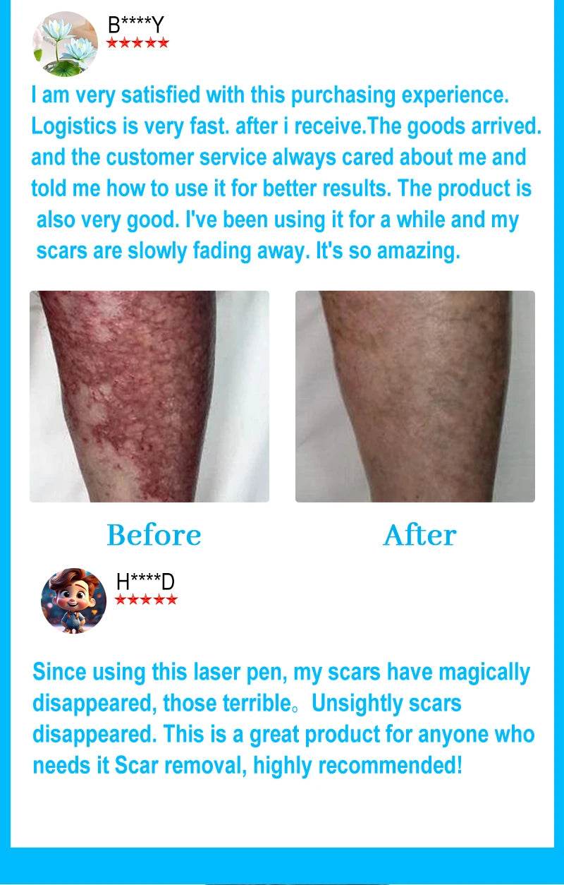 Laser pointer, scars disappear - FLORANZANI- Beauté & Santé