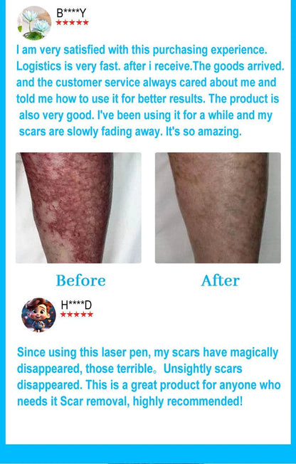 Laser pointer, scars disappear - FLORANZANI- Beauté & Santé