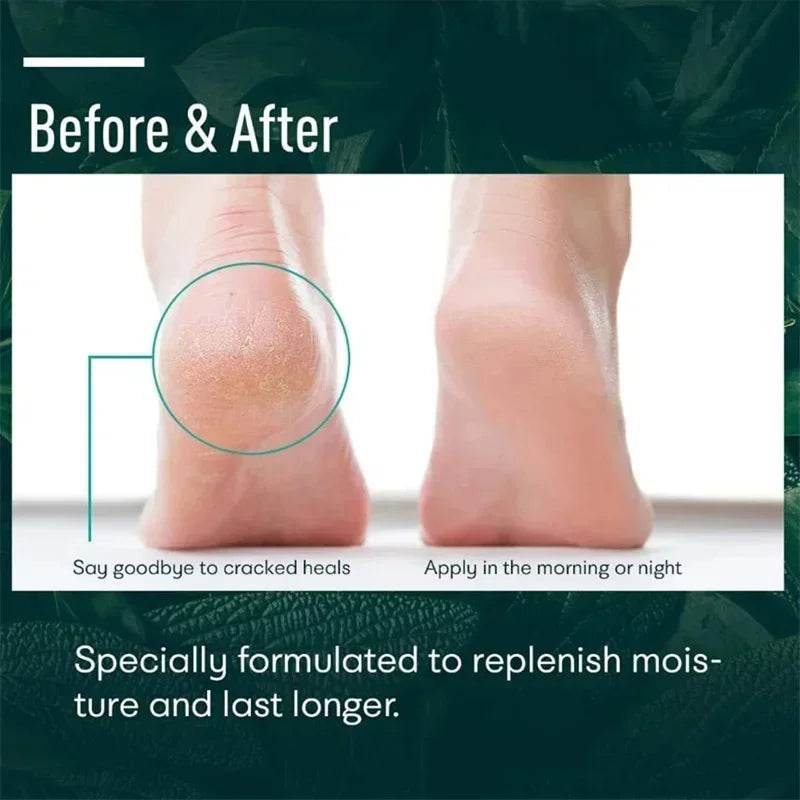 Herbal Anti Crack Foot Cream Heel Cracking Repair Products Exfoliation Dead Skin Removal Softening Moisturize Smooth Skin Care - FLORANZANI- Beauté & Santé