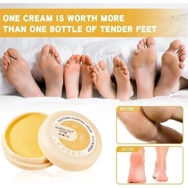 Anti Drying Cracking Foot Cream Heel Cracked Repair Oil Removal Calluses Dead Skin Anti Chapping Moisturize Hand Foot Skin Care - FLORANZANI- Beauté & Santé