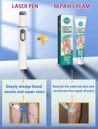 Blue Laser Heals Leg Veins - FLORANZANI- Beauté & Santé