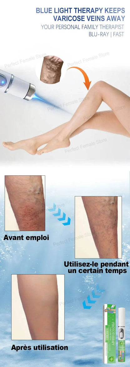 Varicose Veins Products - FLORANZANI- Beauté & Santé