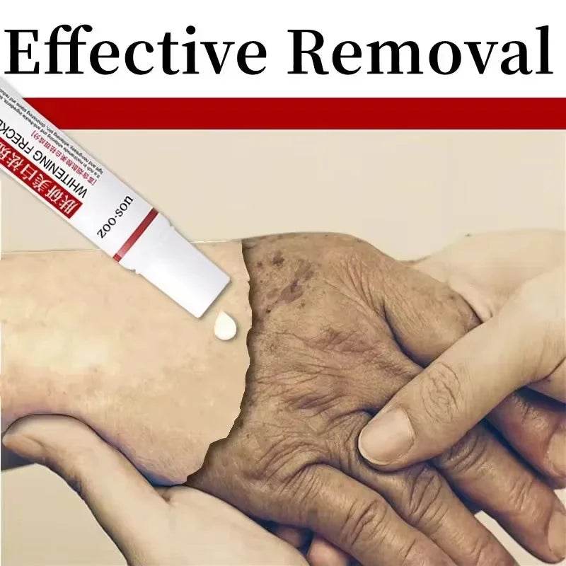 Powerful Spot-removing Whiten Cream Brighten Skin Fast Eliminates Melanin Pigmentation Melasma Dark Spots Korean Skin Care - FLORANZANI- Beauté & Santé