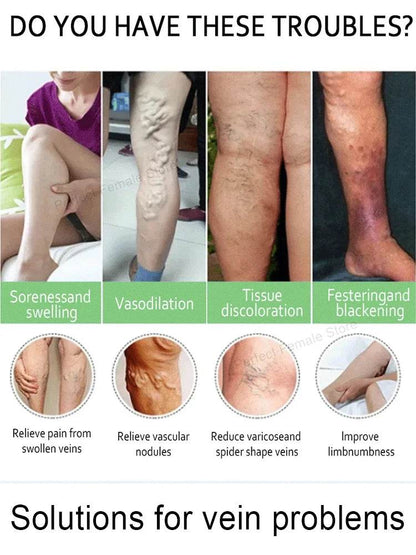 Varicose Veins Products - FLORANZANI- Beauté & Santé