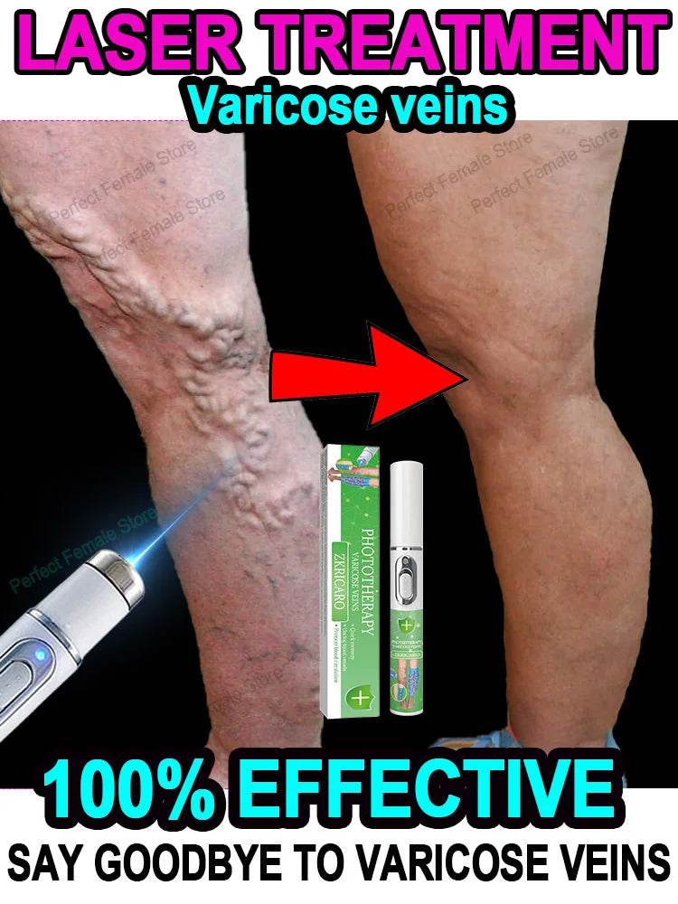 Varicose Veins Products - FLORANZANI- Beauté & Santé