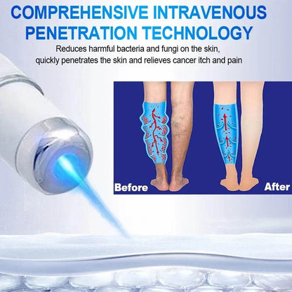 Laser Therapy For Blue Light Pen - FLORANZANI- Beauté & Santé