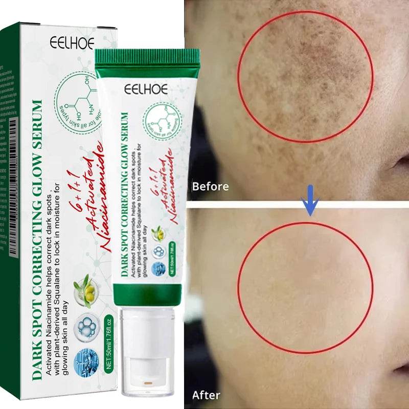 Nicotinamide Whitening Freckles Face Cream Remove Melasma Dark Spots Corrector Fade Melanin Acne Anti-Aging Brighten Skin Care - FLORANZANI- Beauté & Santé