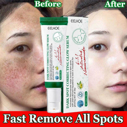 Nicotinamide Whitening Freckles Face Cream Remove Melasma Dark Spots Corrector Fade Melanin Acne Anti-Aging Brighten Skin Care - FLORANZANI- Beauté & Santé