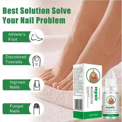 Nail Fungus Treatment Serum Toe Fungal Repair Removal Gel Hand Foot Care Anti Infection Onychomycosis Paronychia Products New - FLORANZANI- Beauté & Santé