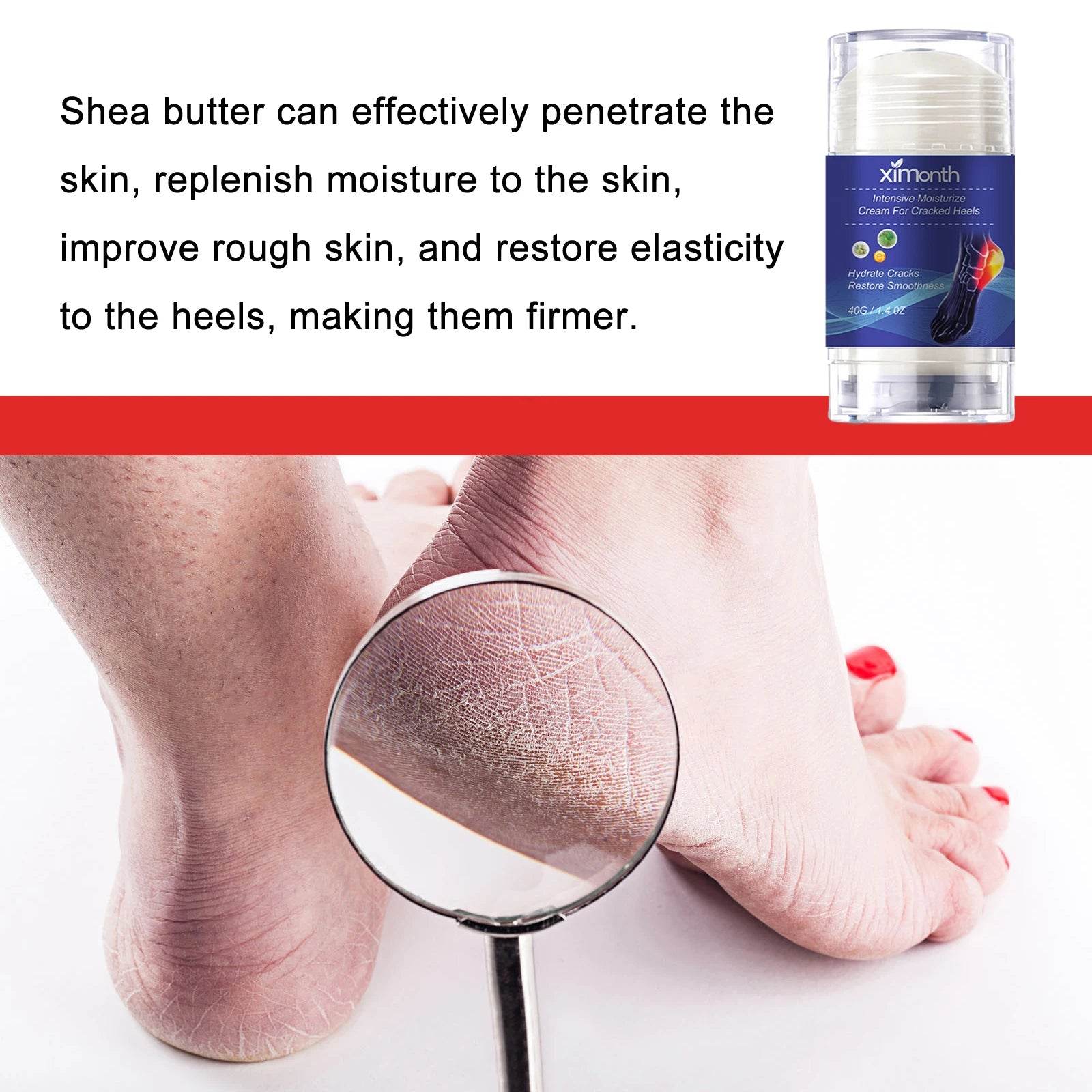 Heel Foot Cream Hydrating Feet Heel Gentle Exfoliation Moisturizing Softening Foot Skin Anti Cracking Dry Peeling Foot Care Crea - FLORANZANI- Beauté & Santé