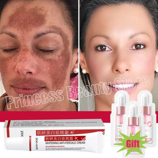 Powerful Spot-removing Whiten Cream Brighten Skin Fast Eliminates Melanin Pigmentation Melasma Dark Spots Korean Skin Care - FLORANZANI- Beauté & Santé