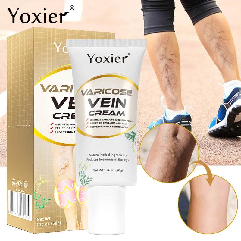 Varicose Vein Repair Cream Vasculitis Phlebitis Massage Relieve Swelling Pain Nourish Emove Earthworm Leg Promotes Blood 50g - FLORANZANI- Beauté & Santé