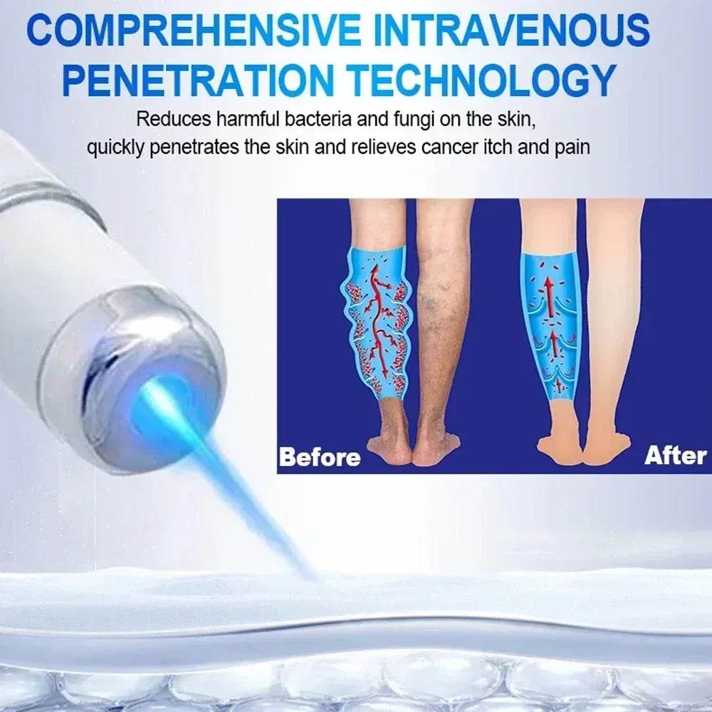 Laser Therapy For Blue Light Pen - FLORANZANI- Beauté & Santé