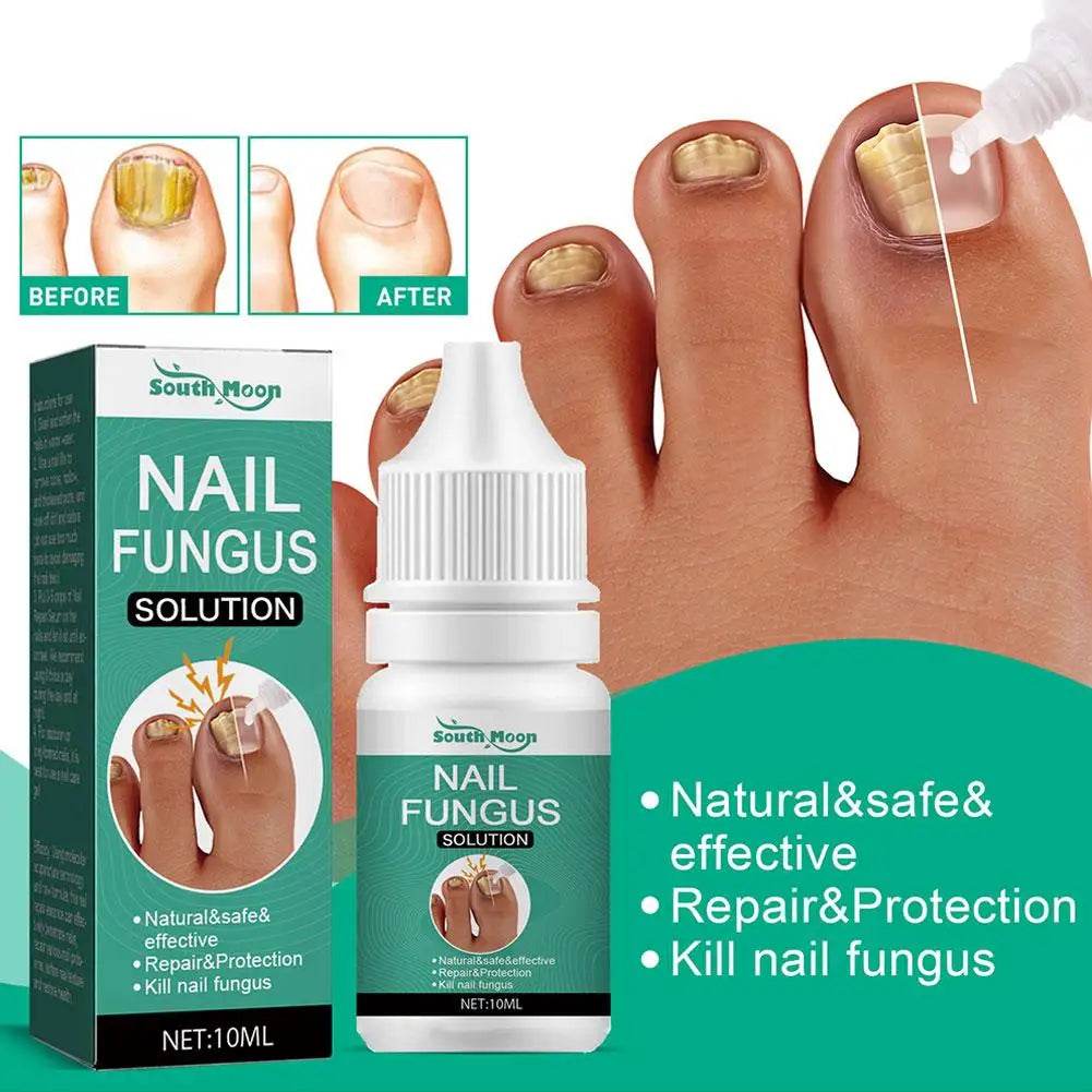 Strong Nail Fungus Treatment Serum Essence Feet Removal Anti Toe Essence Serum Fungal Repa Infection Cream Care Nails J2t0 - FLORANZANI- Beauté & Santé