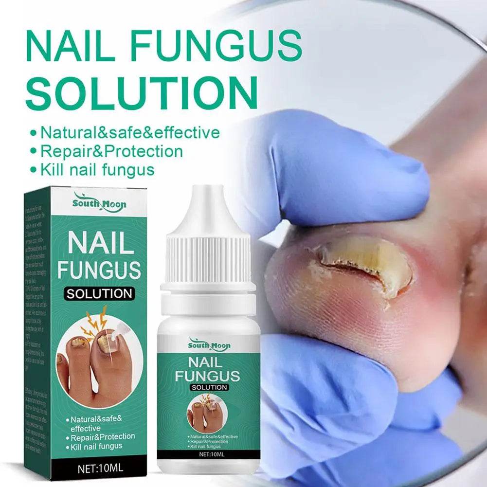 Strong Nail Fungus Treatment Serum Essence Feet Removal Anti Toe Essence Serum Fungal Repa Infection Cream Care Nails J2t0 - FLORANZANI- Beauté & Santé