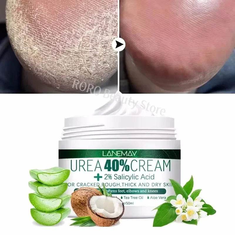 Herbal Anti Crack Foot Cream Heel Cracking Repair Products Exfoliation Dead Skin Removal Softening Moisturize Smooth Skin Care - FLORANZANI- Beauté & Santé