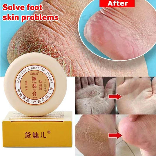 Anti-drying Crack Foot Cream Heel Cracked Repair Cream Mask Oil Moisturizing Removal Dead Skin Hand Feet Smooth Care Product - FLORANZANI- Beauté & Santé