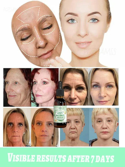 wrinkles disappear 100% younger - FLORANZANI- Beauté & Santé