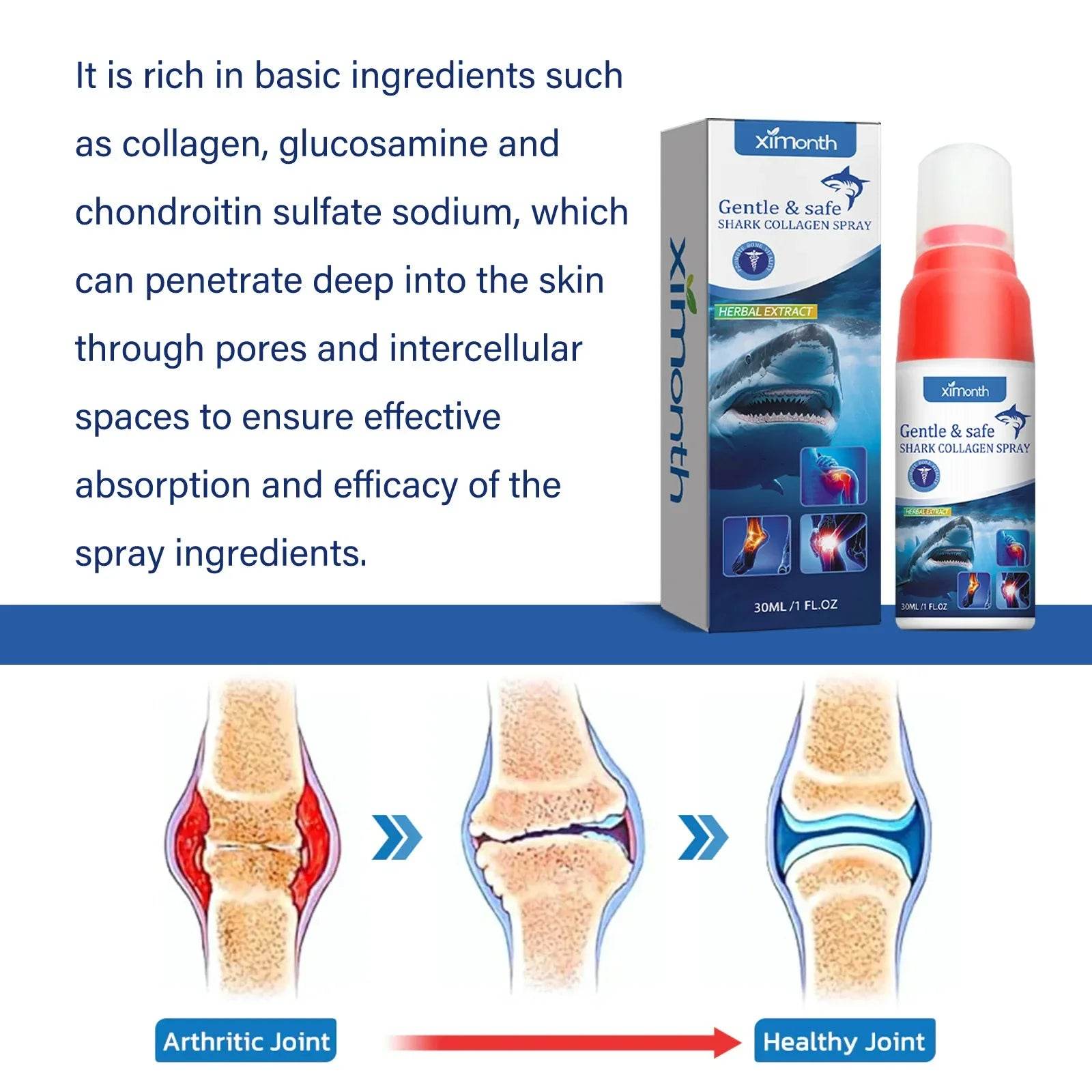 30ml Anti Pain Ointment Knee Relief Spray Relieve Knee Arthritis Soothes Health Treatment Pain Joint Care Body Foot 무지외반증교정기 - FLORANZANI- Beauté & Santé