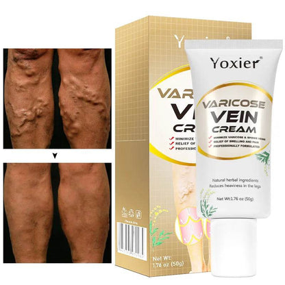 Varicose Vein Repair Cream Vasculitis Phlebitis Massage Relieve Swelling Pain Nourish Emove Earthworm Leg Promotes Blood 50g - FLORANZANI- Beauté & Santé