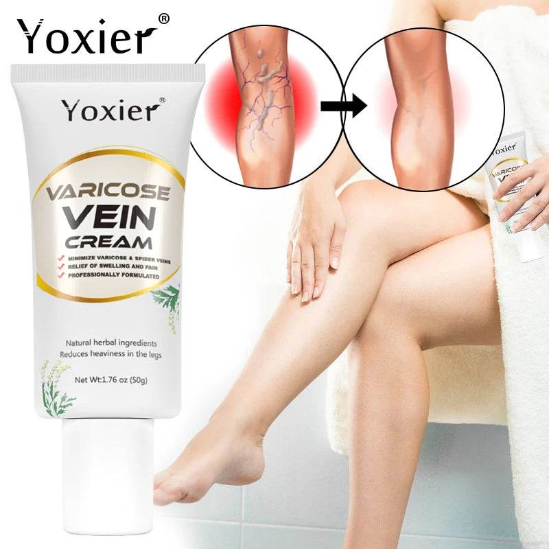 Varicose Vein Repair Cream Vasculitis Phlebitis Massage Relieve Swelling Pain Nourish Emove Earthworm Leg Promotes Blood 50g - FLORANZANI- Beauté & Santé