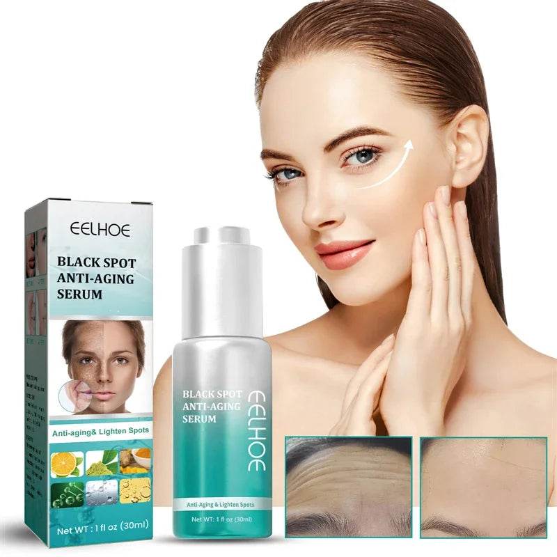 Effective Whitening Serum Remove Dark Spots Freckle Essence Anti-Aging Fade Pigmentation Melasma Brighten Beauty Face Skin Care - FLORANZANI- Beauté & Santé