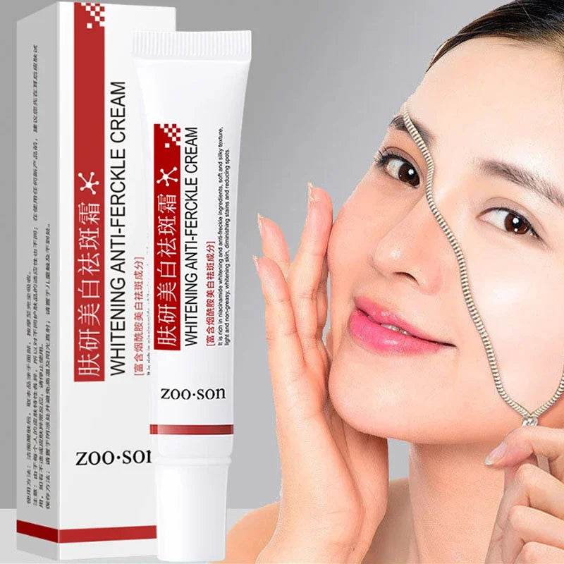 Powerful Spot-removing Whiten Cream Brighten Skin Fast Eliminates Melanin Pigmentation Melasma Dark Spots Korean Skin Care - FLORANZANI- Beauté & Santé