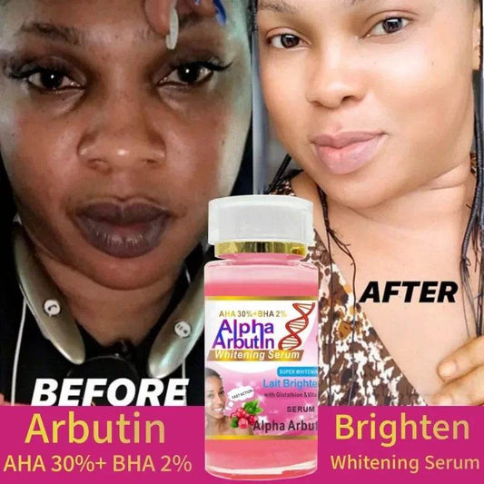 Alpha Arbutin Serum AHA 30%+ BHA 2% Keeps Face Smooth Brightening Moisturizing Improving Dullness Dark Skin Beauty Care Cream - FLORANZANI- Beauté & Santé