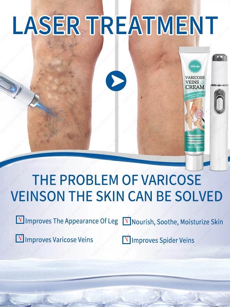 Blue Laser Heals Leg Veins - FLORANZANI- Beauté & Santé