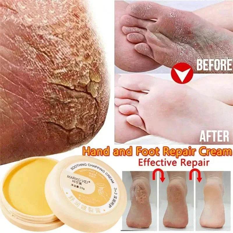 Anti Drying Cracking Foot Cream Heel Cracked Repair Oil Removal Calluses Dead Skin Anti Chapping Moisturize Hand Foot Skin Care - FLORANZANI- Beauté & Santé