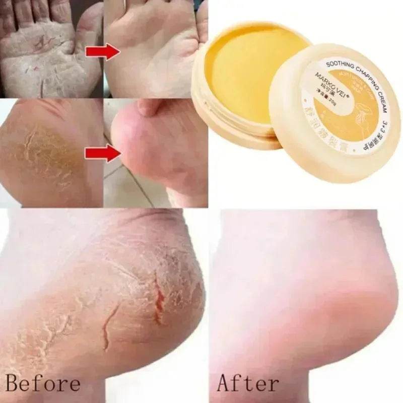 Anti Drying Cracking Foot Cream Heel Cracked Repair Oil Removal Calluses Dead Skin Anti Chapping Moisturize Hand Foot Skin Care - FLORANZANI- Beauté & Santé