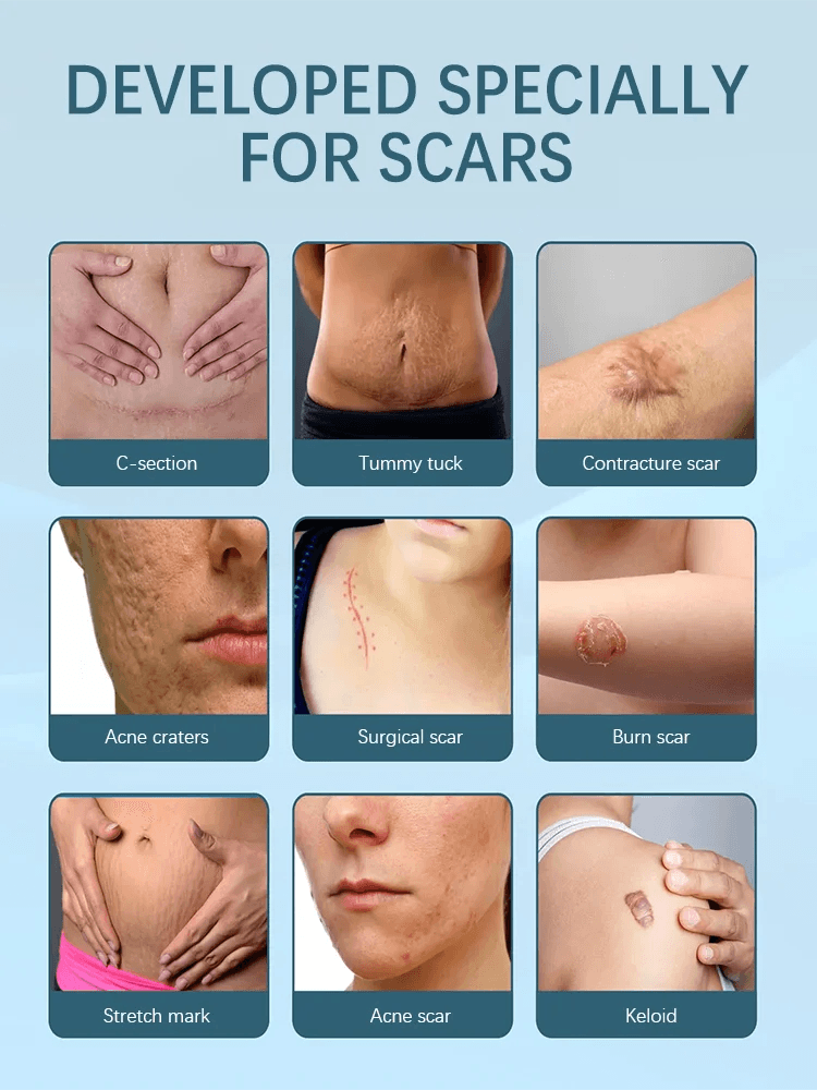 Laser pointer, scars disappear - FLORANZANI- Beauté & Santé