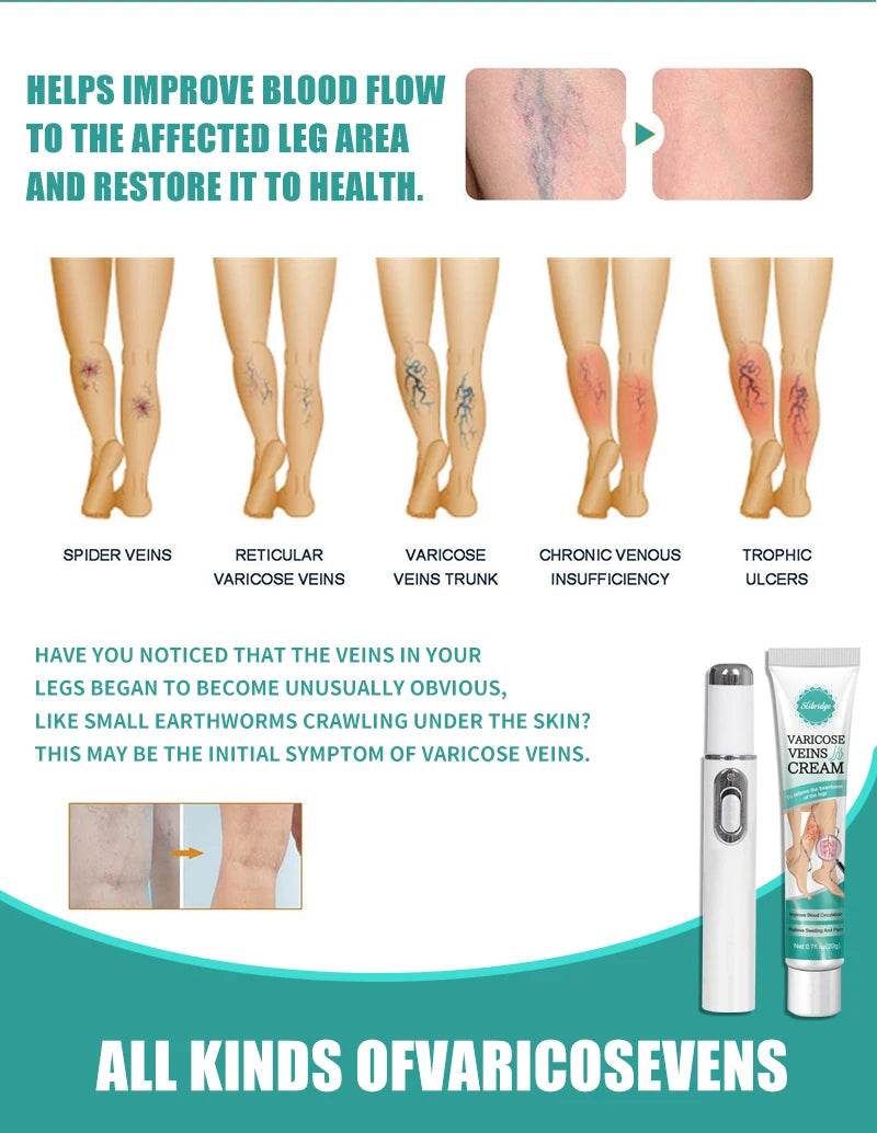 Blue Laser Heals Leg Veins - FLORANZANI- Beauté & Santé