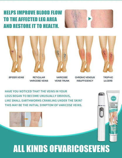 Blue Laser Heals Leg Veins - FLORANZANI- Beauté & Santé