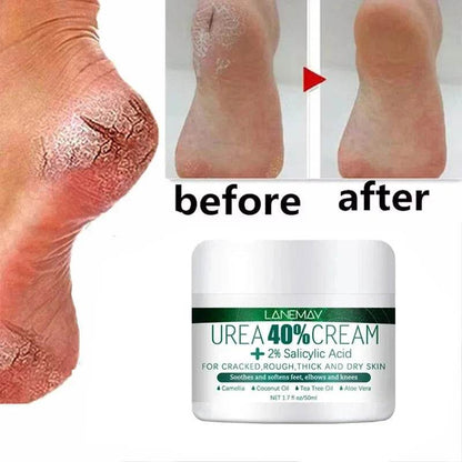 Herbal Anti Crack Foot Cream Heel Cracking Repair Products Exfoliation Dead Skin Removal Softening Moisturize Smooth Skin Care - FLORANZANI- Beauté & Santé