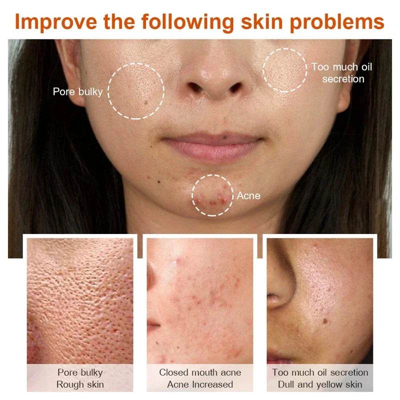 Effective Whitening Serum Remove Dark Spots Freckle Essence Anti-Aging Fade Pigmentation Melasma Brighten Beauty Face Skin Care - FLORANZANI- Beauté & Santé