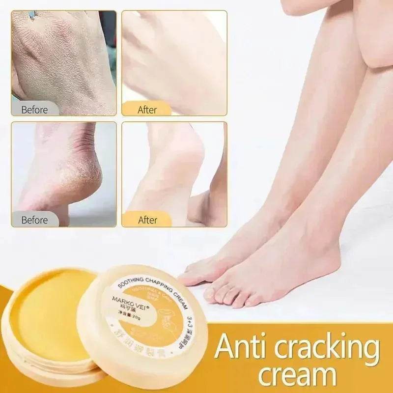 Anti Drying Cracking Foot Cream Heel Cracked Repair Oil Removal Calluses Dead Skin Anti Chapping Moisturize Hand Foot Skin Care - FLORANZANI- Beauté & Santé