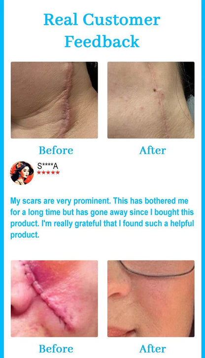 Laser pointer, scars disappear - FLORANZANI- Beauté & Santé