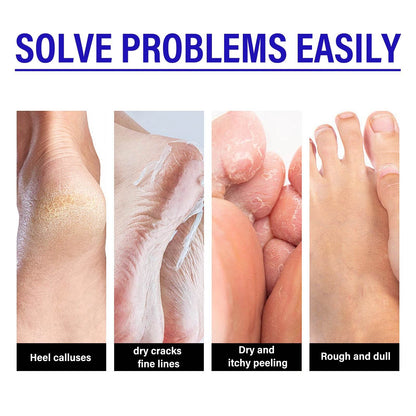 Heel Foot Cream Hydrating Feet Heel Gentle Exfoliation Moisturizing Softening Foot Skin Anti Cracking Dry Peeling Foot Care Crea - FLORANZANI- Beauté & Santé