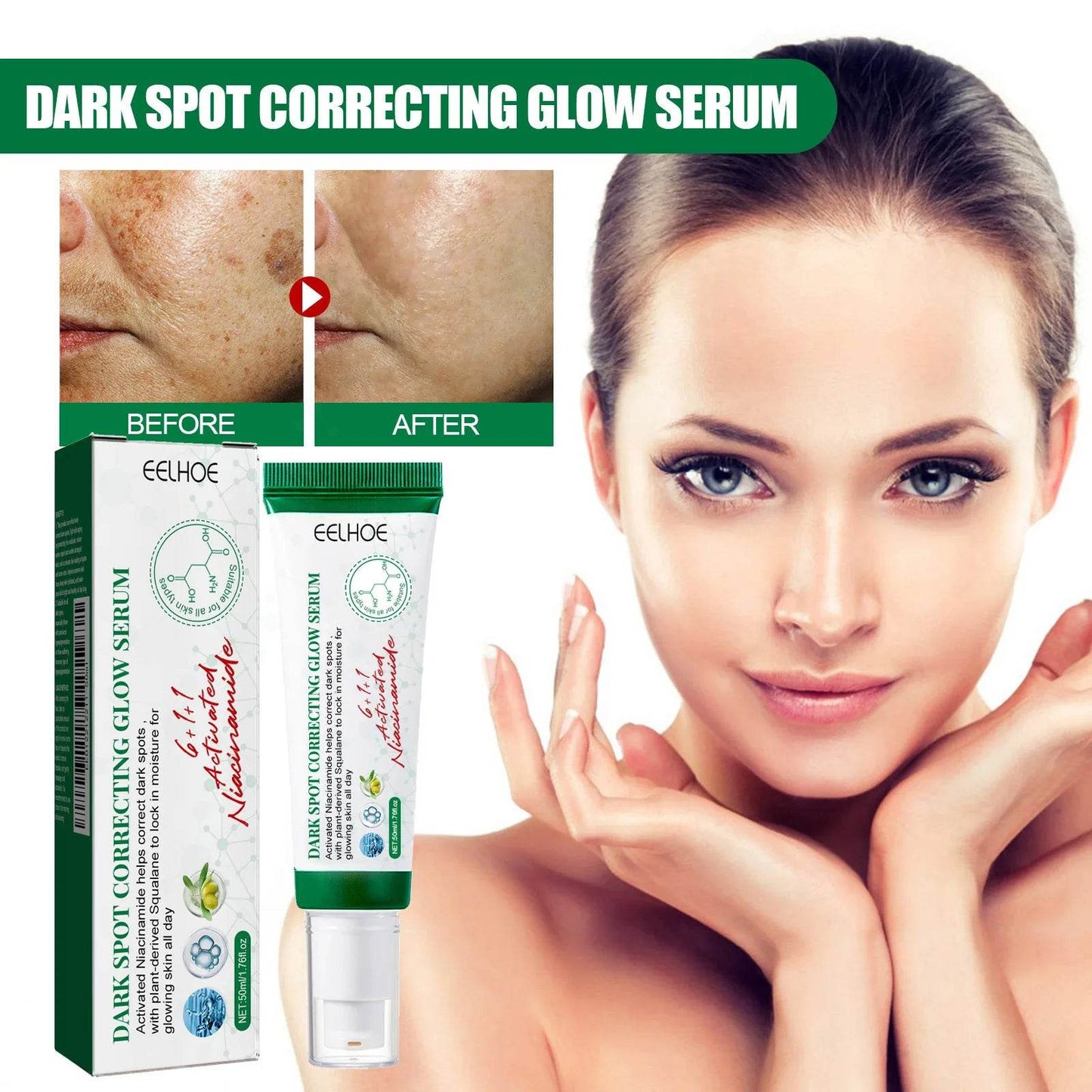 Nicotinamide Whitening Freckles Face Cream Remove Melasma Dark Spots Corrector Fade Melanin Acne Anti-Aging Brighten Skin Care - FLORANZANI- Beauté & Santé