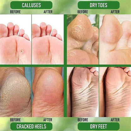 Herbal Anti Crack Foot Cream Heel Cracking Repair Products Exfoliation Dead Skin Removal Softening Moisturize Smooth Skin Care - FLORANZANI- Beauté & Santé