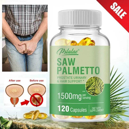 Premium Saw Palmetto - Promotes Male Prostate Health, Prevents Hair Loss, Relieves Frequent Urination, and Promotes Vitality - FLORANZANI- Beauté & Santé