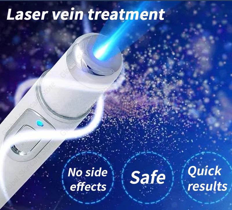 Blue Laser Heals Leg Veins - FLORANZANI- Beauté & Santé