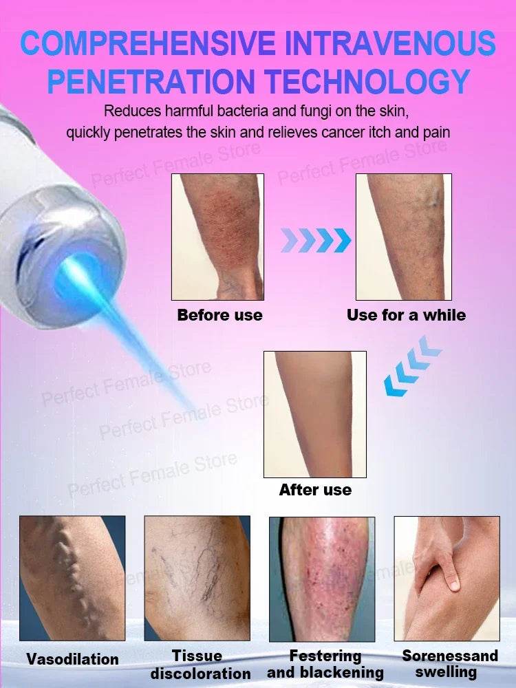 Varicose Veins Products - FLORANZANI- Beauté & Santé