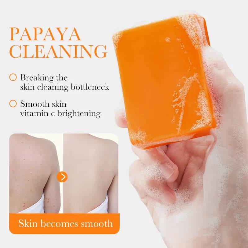 1Box Papaya Handmade Soap Vitamin C Facial and Bath Soaps Body Care Skin Deep Clean Skin Removal Products Body Brighten - FLORANZANI- Beauté & Santé