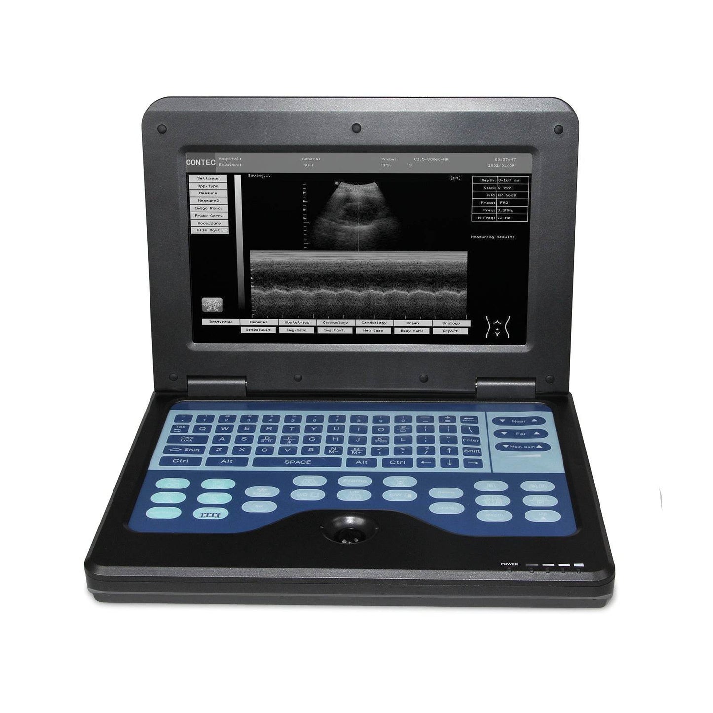 Digital Laptop Machine Ultrasound Scanner Convex 3.5Mhz Probe Abdominal For Human Use - FLORANZANI- Beauté & Santé