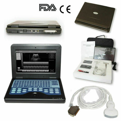 Digital Laptop Machine Ultrasound Scanner Convex 3.5Mhz Probe Abdominal For Human Use - FLORANZANI- Beauté & Santé