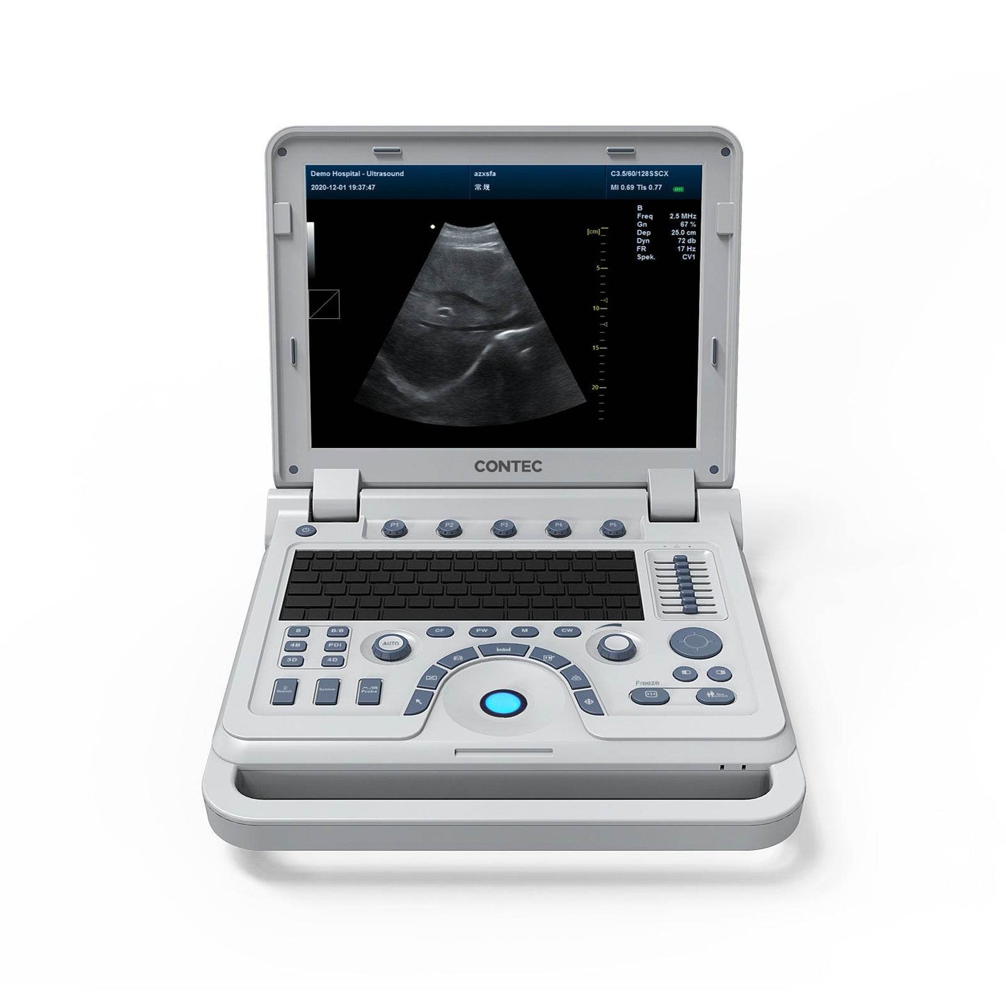 VET Veterinary Portable Ultrasound Scanner Laptop Machine Color Doppler For Pregnancy In Animals - FLORANZANI- Beauté & Santé